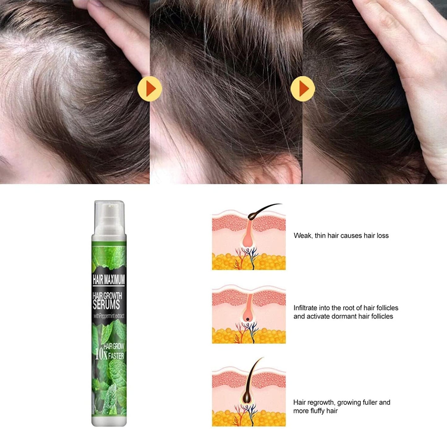 spray anti-chute des cheveux