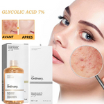 Charger l'image dans la galerie, The Ordinary Lotion tonique exfoliante à l’acide glycolique 7% 240ml