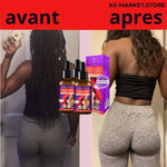 Charger l&#39;image dans la galerie, GARLIC HIP BOOST
