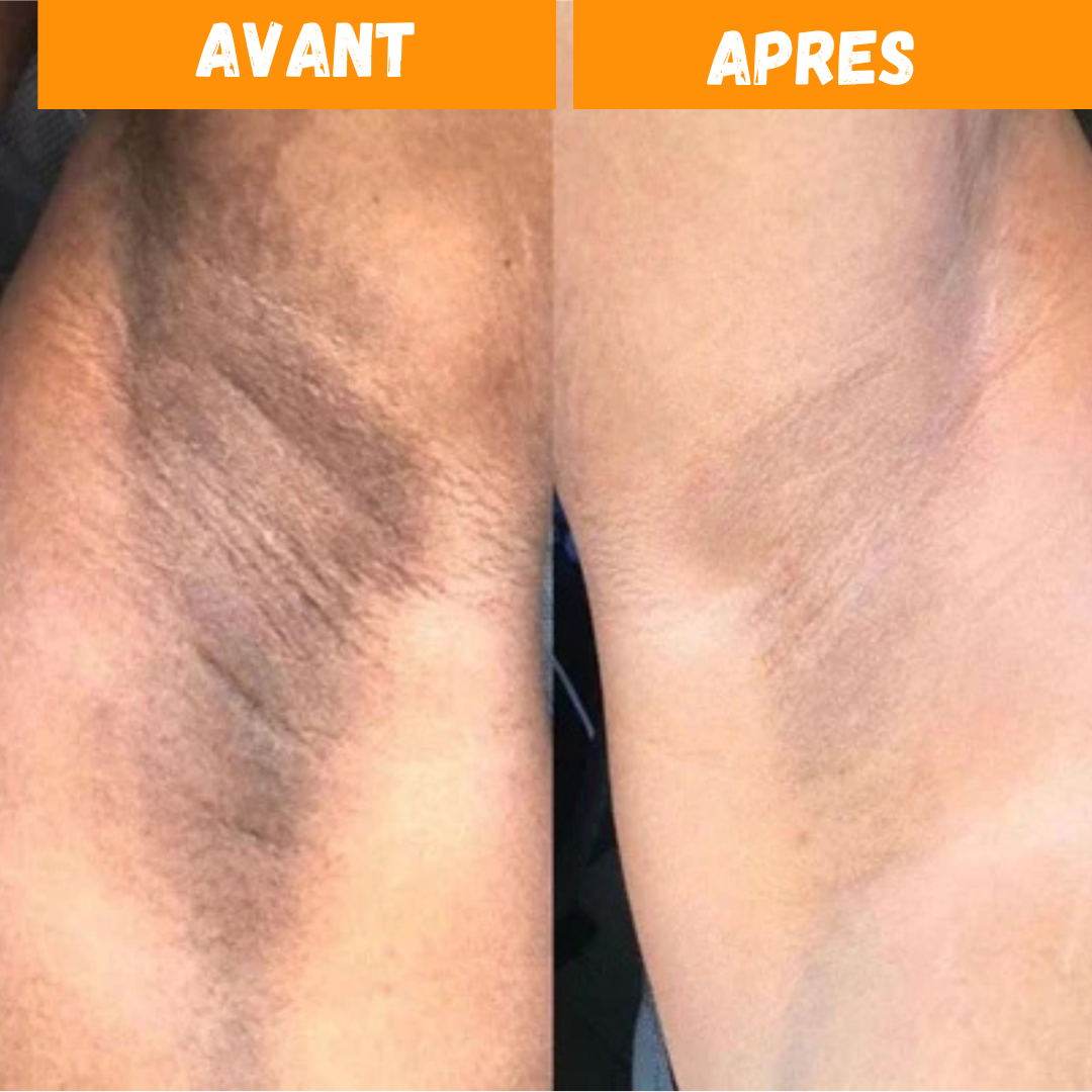 Savon Nettoyant au Kojic - Stock Limité