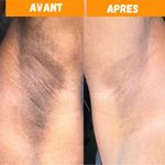 Charger l&#39;image dans la galerie, Savon Nettoyant au Kojic - Stock Limité
