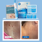 Charger l&#39;image dans la galerie, KIT-ANTI-ETIQUETTE-DE PEAU
