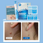 Charger l&#39;image dans la galerie, KIT-ANTI-ETIQUETTE-DE PEAU
