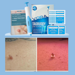 Charger l&#39;image dans la galerie, KIT-ANTI-ETIQUETTE-DE PEAU
