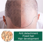 Charger l&#39;image dans la galerie, spray anti-chute des cheveux
