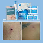 Charger l&#39;image dans la galerie, KIT-ANTI-ETIQUETTE-DE PEAU
