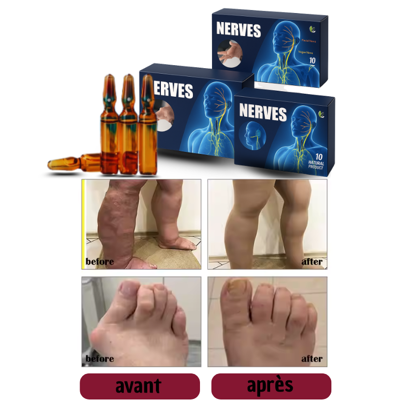 NERVES ANTI-DOULEURS
