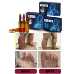 Charger l&#39;image dans la galerie, NERVES ANTI-DOULEURS
