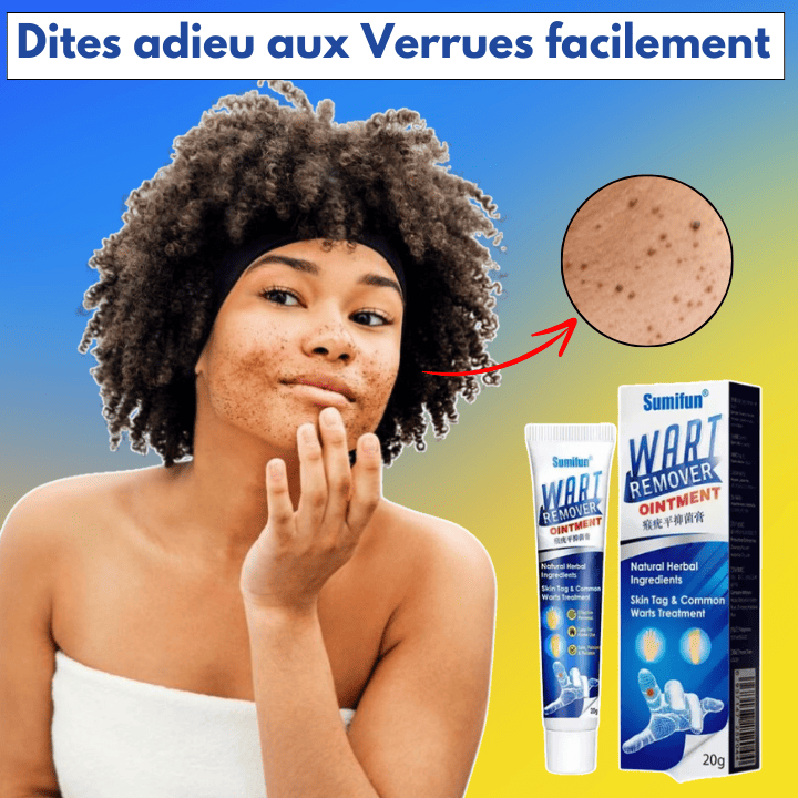 Crème médicale naturelle pour les verrues cutanées