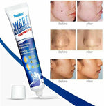 Charger l&#39;image dans la galerie, Crème médicale naturelle pour les verrues cutanées
