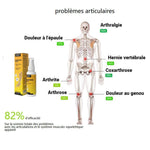 Charger l&#39;image dans la galerie, Spray pour les douleurs articulaires
